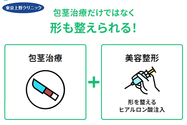 東京上野クリニックポイント3