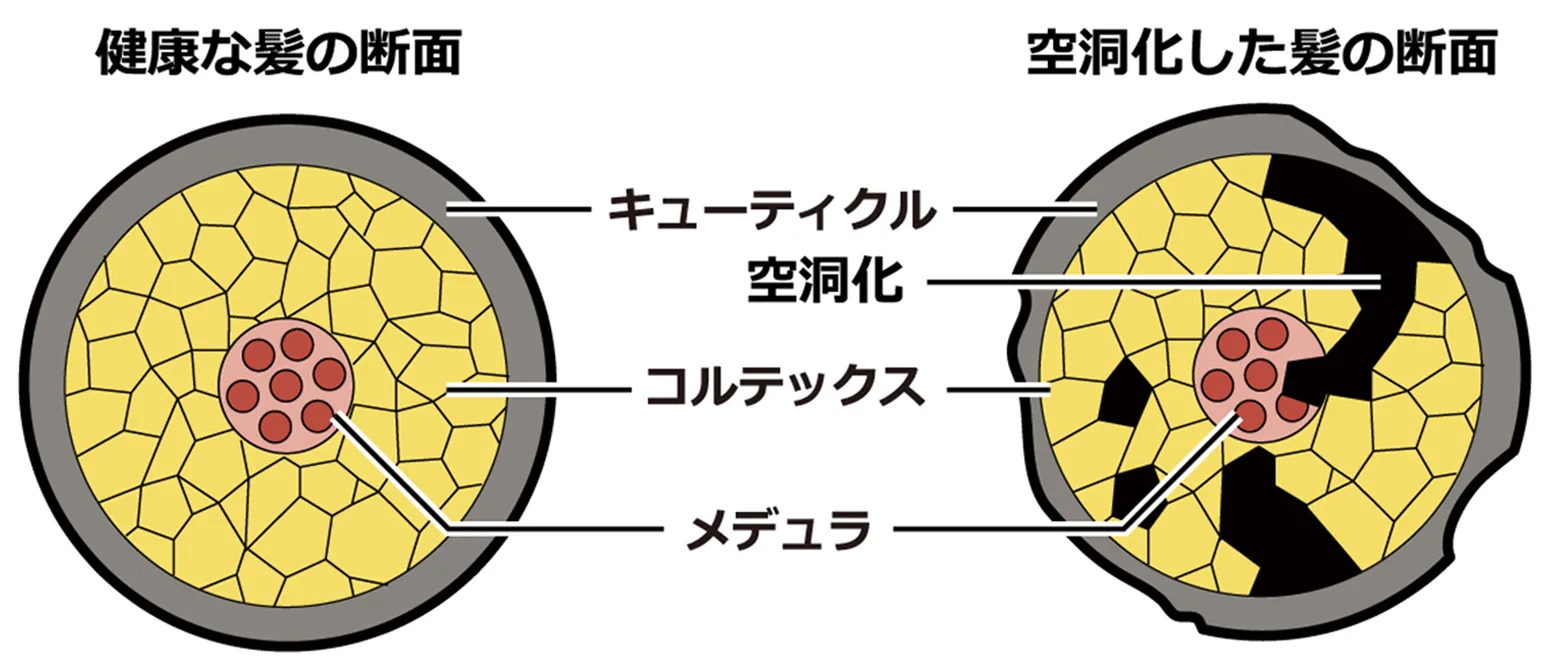 うねり原因はキューティクルのダメージ1