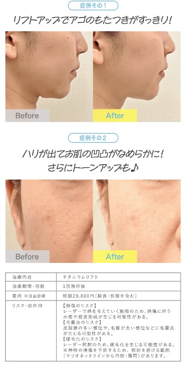 症例写真