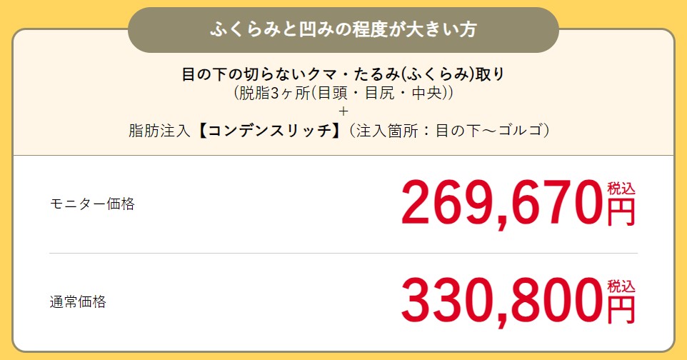 ふくらみと凹みの程度が大きい方