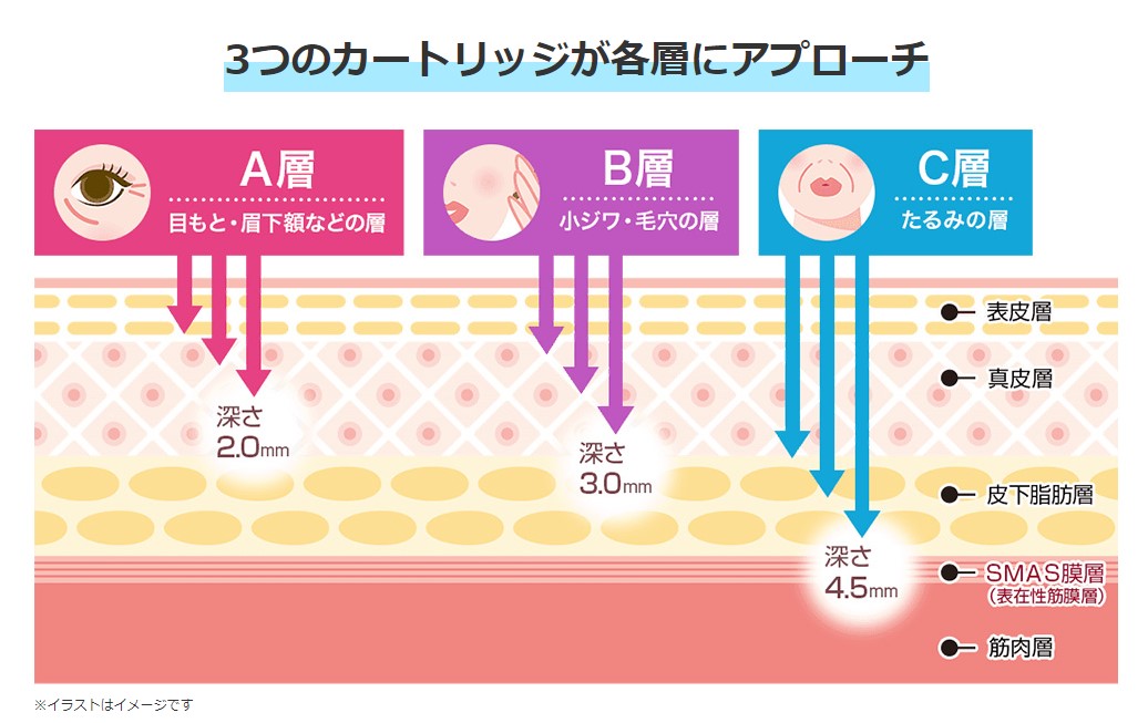 カートリッジの詳細