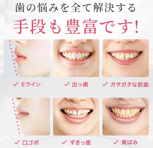 キレイライン矯正イメージ5