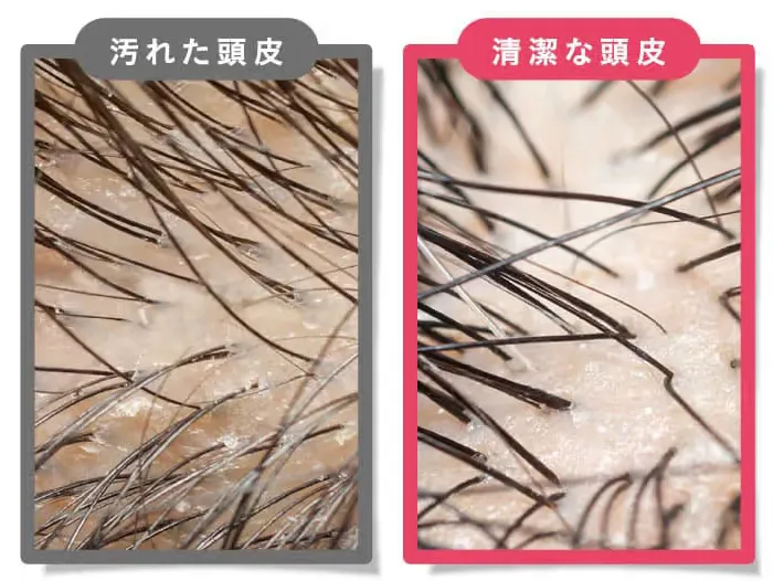 紫外線による頭皮ケアも忘れずに