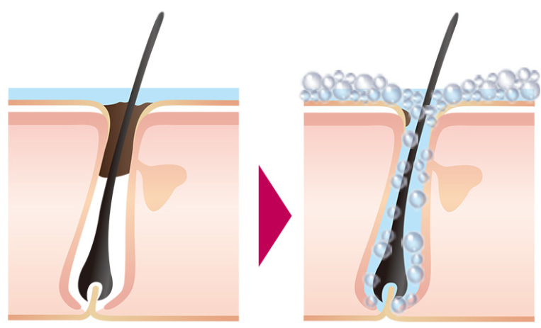 .頭皮汚れのクレンジング